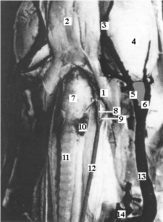 Az arteri carotis communis elhelyezkedése