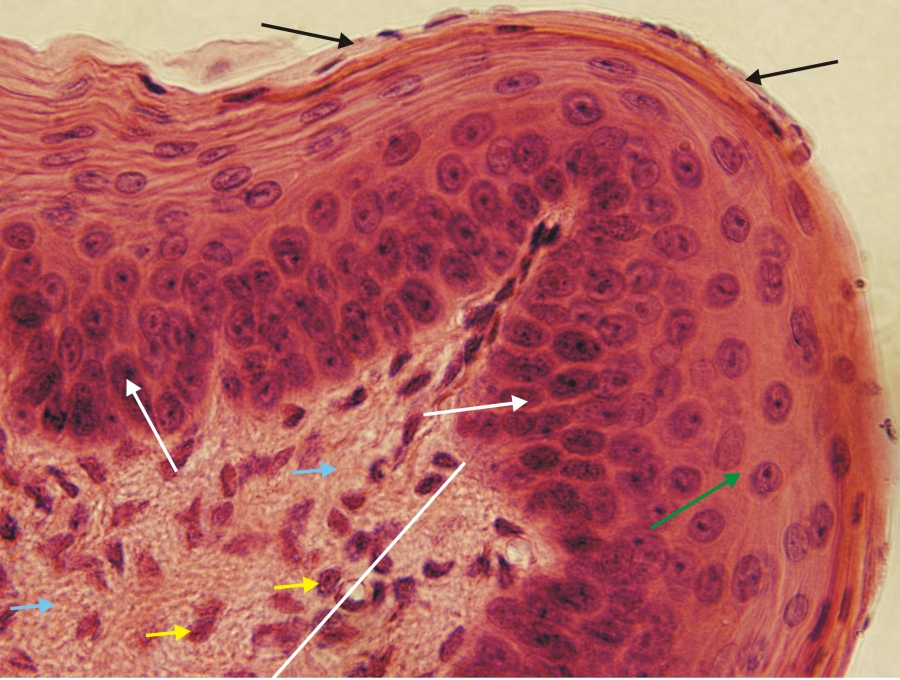 A tumor hisztológiai osztályozása - A kötőszövet hisztogenezisének növekedése és regenerálása